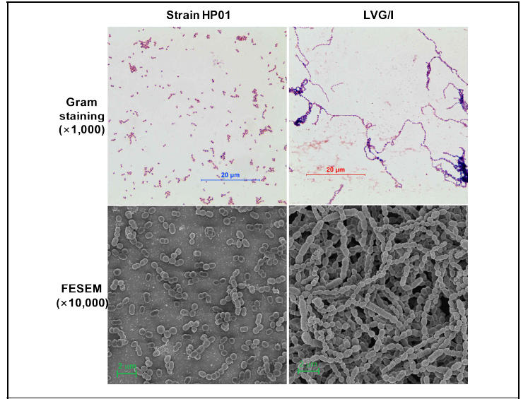 균주 HP01과 표준균주 S. oralis LVG/I의 정체기에 tryptic soy broth 배양액 샘플들을 그람염색하여 광학현미경으로 촬영한 사진들 (위)과 아래에 침전한 세포들을 silicon wafer에 고정한 후 촬영한 주사전자현미경 사진들 (아래)
