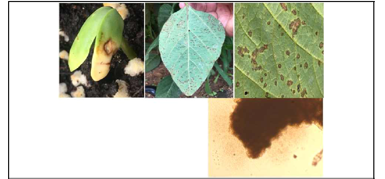 콩 세균성점무늬병(bacterial leaf spot)