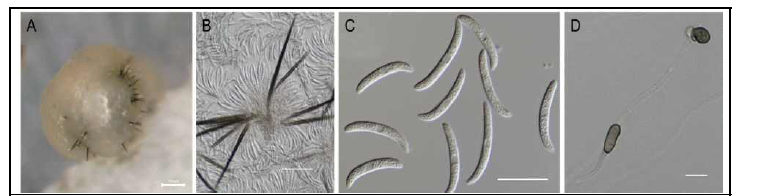 Colletotrichum truncatum에 의한 콩뿌리썩음병의 균학적 특성 (A: 균총(100um), B: 포자 및 강모(50um), C; 분생포자(20um), D: 부착기(10um)