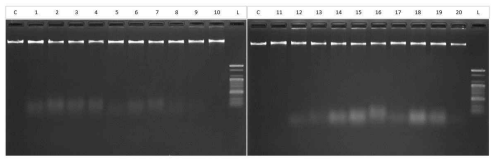 선별된 중요 내성균의 genomic DNA 전기영동 결과