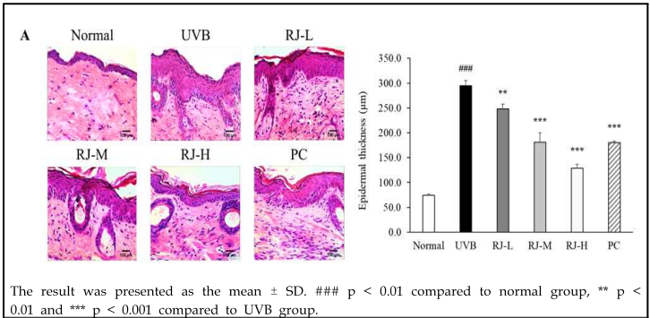 UV조사된 SKH1 마우스 모델에서 로열젤리 경구투여에 따른 조직학적 관찰 및 표피 두께 변화