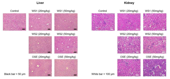 간과 신장의 조직병리학적 소견 (H&E 염색)