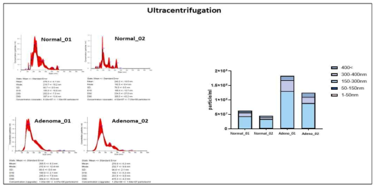 Ultracentrifugation 기법을 이용한 혈장 엑소좀 분리 결과