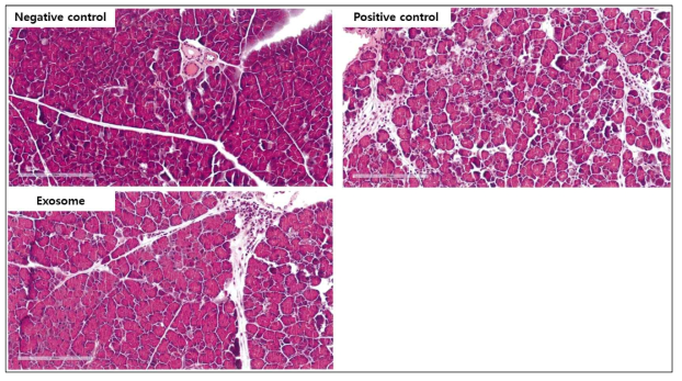 음성대조군(Negative control), 급성 췌장염 유도군(Positive control), 줄기세포 엑소좀 투여군(Exosome)에서 췌장조직의 병리학적 병변 사진