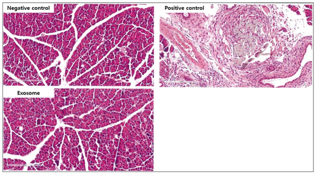 음성대조군(Negative control), 만성 췌장염 유도군(Positive control), 줄기세포 엑소좀 투여군(Exosome)에서 췌장조직의 병리학적 병변 사진