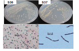 다이아지논 분해 S36, S37 균주의 (위) 콜로니 형태 및 (아래) gram staining 특성.