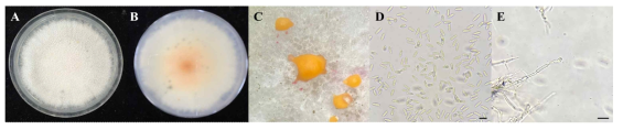 키위 과피흑색반점에서 분리된 병원균 Colletotrichum fioriniae의 균총 및 분생포자 A, B: Colletotrichum fioriniae의 균총, C: 분생포자덩어리, D: 분생포자, E: 분생포자경. Scale bar = 10 ㎛
