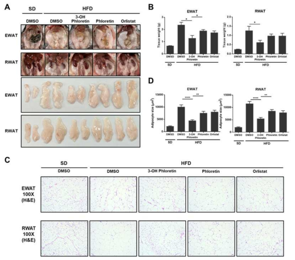 3-OH phloretin suppressed HFD-induced increases in white adipose tissue size, weight, and adipocyte size. (A) Representative images of the EWAT and RWAT were shown. (B) Weight and (D) adipocyte size of EWAT and RWAT of mice were represented as bar graphs. (C) White adipose tissues sections were stained with H&E staining. Histological analysis was examined under the light microscope at x100 magnification. Data are shown as the mean ± standard error of the mean (SEM) (*p < 0.05, **p < 0.01, ***p < 0.001)