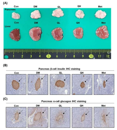 Effects of quinizarin and metformin on morphology and histology analysis in liver and pancreas tissue. (A) Morphology of liver and pancreas, (B) immunohistochemistry (IHC) staining of β-cell in pancreas, (C) immunohistochemistry (IHC) of α-cell in pancreas