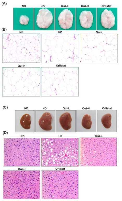 Effects of quinizarin on lipid deposition in epididymal fat tissues and liver tissues