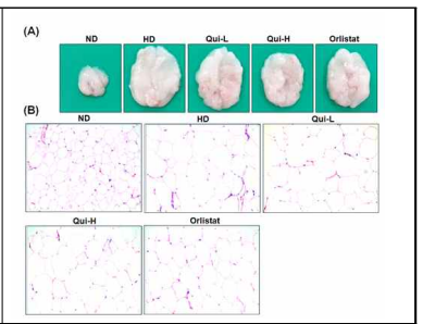 C57BL/6 비만 마우스 모델에서 Quinizarin 경구 투여에 의해 유도된 (A) 부고환지방 감소 및 (B) 부고환지방 조직 내 지방세포 크기 감소 효과