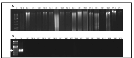 강원도 지역에서 채집한 백합대화병 유사 증상을 나타내는 백합에서 분리한 세균 균주의 total DNA (A)와 R. fascians 의 chromosome을 targeting한 primer RS02785를 이용하여 PCR한 전지 영동 사진. M: 1-kb DNA ladder (BIOFACT, Co. Ltd.), Rf: R. fascians, Lane 159-1~161-1: 초시길 99, Lane (162-1~165-1): 왕산로 1245, Lane (166-1~173-1): 박월길 71-638, Lane (174-1~177-1): 김유정로 159-21. 화살표: 258bp