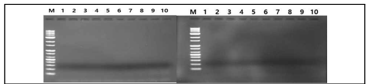 당근 재배지에서 채취한 토양의 현탁액에서 분리한 total DNA를 대상으로 당근 세균잎마름병균 X. hortorum pv. carotae를 타겟으로 하여 특이적으로 증폭시키는 specific primer를 이용하여 PCR 증폭한 결과 (M: marker-1kb, lane 1–10 분리 토양)