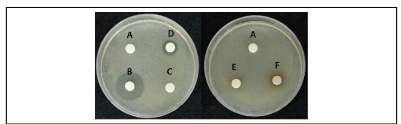 당근세균잎마름병균 X. hortorum pv. carotae에 대한 H2O (A), oxolinic acid (B), kasugamycin (C), streptomycin (D), copper hydroxide (E), copper sulfate basic (F)의 직접 적인 항균 효과