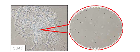 SP6C4의 SEME배지 배양액 현미경분석 결과(×1,000).