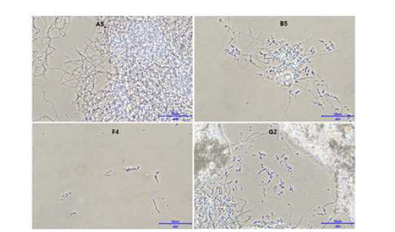 SP6C4의 영양원(Nitrogen source) 최적화 스크리닝 현미경 관찰 결과(×400).