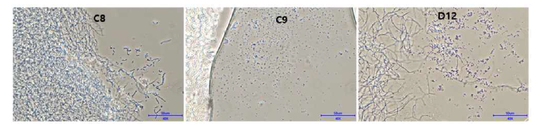 SP6C4의 영양원(Peptide Nitrogen source) 최적화 스크리닝 현미경관찰 결과(×400).