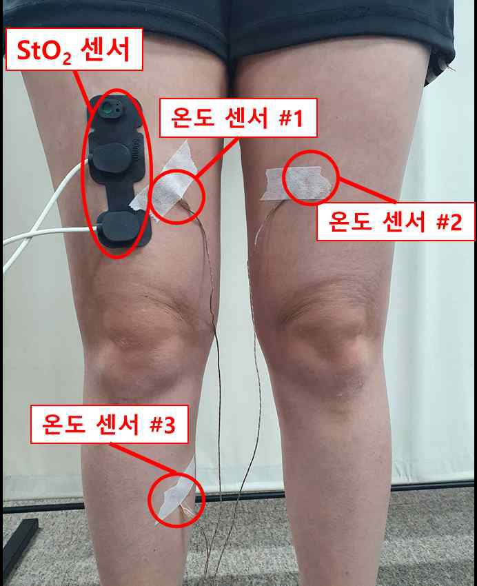 StO2 및 온도 센서 부착