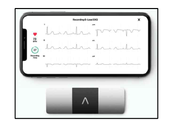 Kardiamobile 6L (https://www.alivecor.kr/main/html.ph p?htmid=service/product2.html)