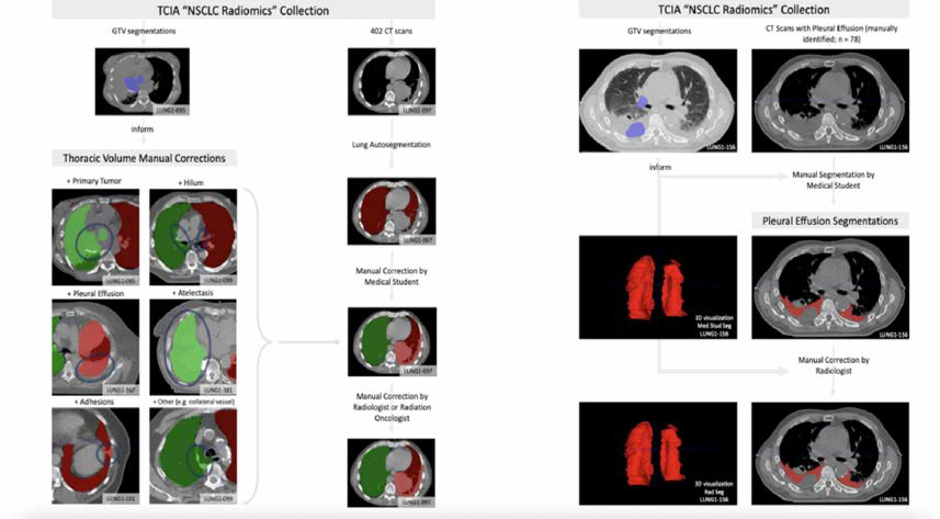 Image visualization of The Cancer Imaging Archive