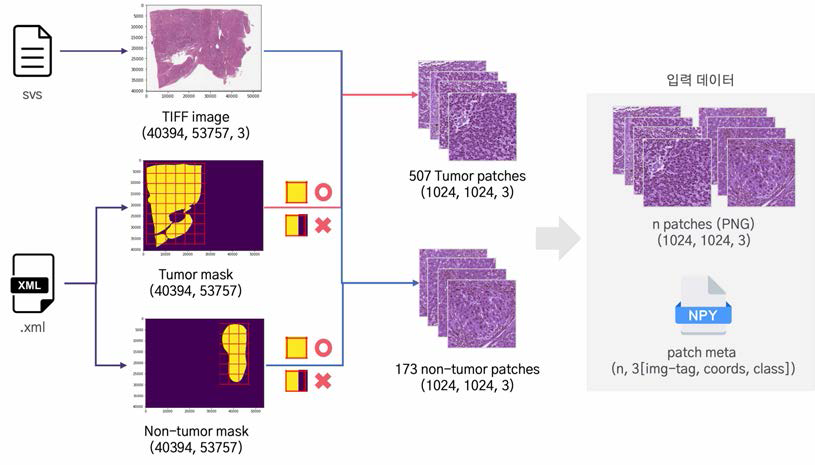 Preprocess of Whole Slide Image