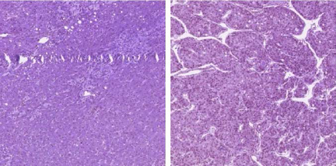 Example of WSI, non-tumor (left), tumor (right)