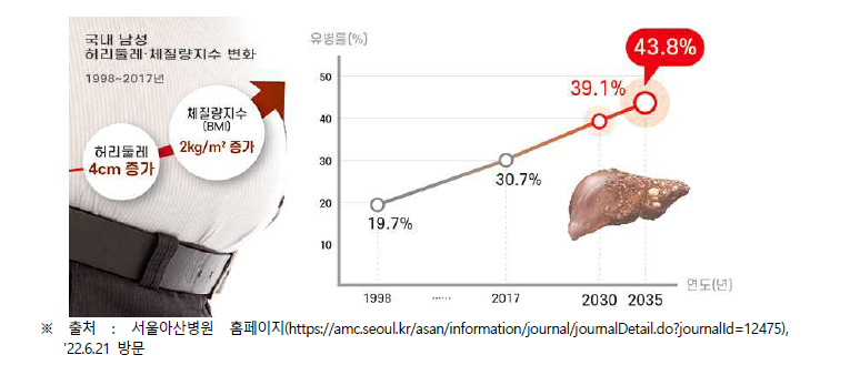 국내 남성 비알코올성 지방간 유병률 전망