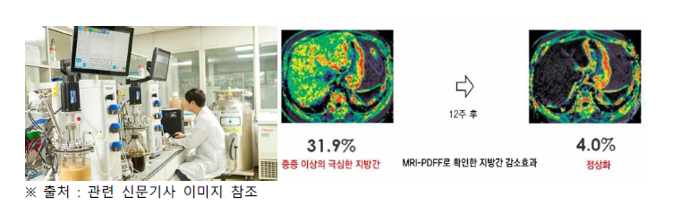 NAFLD 신약개발 관련 기사(이미지)