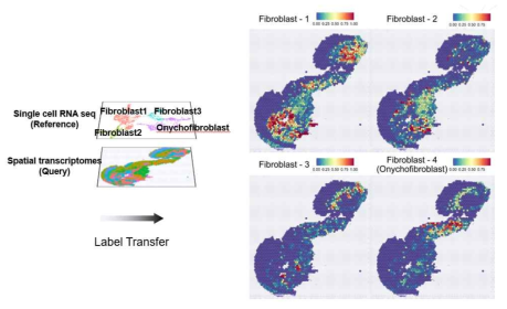 섬유아세포의 위치를 공간전사체 데이터에서 맵핑한 결과 (Unpublished)