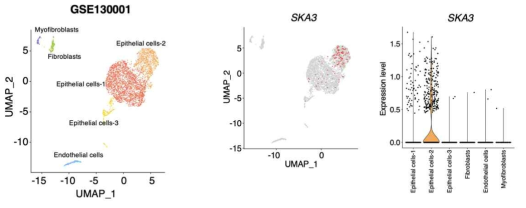 방광암 환자의 단일세포 전사체 분석