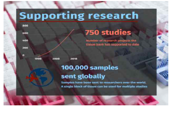 Parkinsons UK Brain Bank - Supporting research
