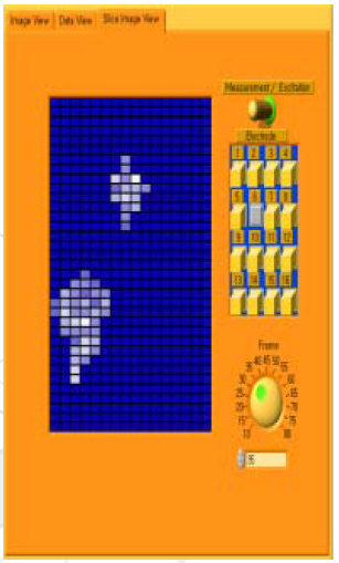 Slice Image View