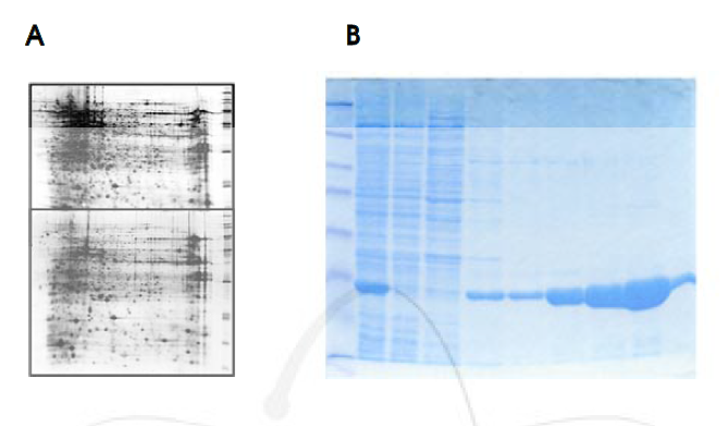 Deinococcus의 2-D 전기영동 결과(A) 및 DinB-like protein의 분리 정제(B)