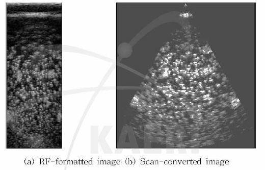 RF- and scan- 변환 화상