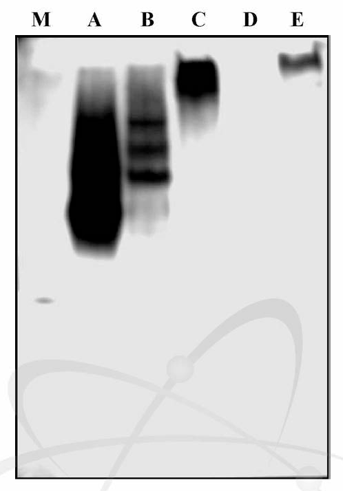 Immunoblotting profile of Modified ovalbumin using egg white-allergic patients' IgE. Numbers on the left side indicate the molecular weight (kDa) of the standard marker. M indicated molecular weight standard marker. Each of alphabet indicated that A means intact OVA，B means GA treated，C means 10 kGy irradiated OVA，D means 10 kGy irradiated / GA，E means GA / 10 kGy irradiated