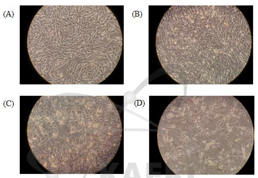 Radiation-induced cell morphological change of HepG2 cells. Cells were exposed to 5 Gy. A: 0 h after IR exposure, B: 24 h after IR exposure, C: 48 h after IR exposure, D: 72 h after IR exposure