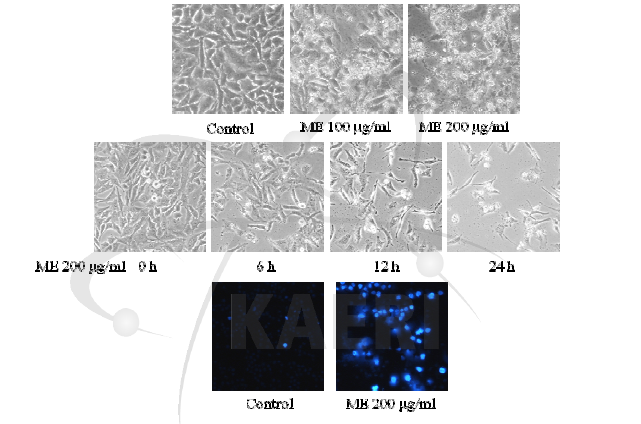 외톨개 모자반 추출물(ME)에 의한 Hela cell의 형태 변화