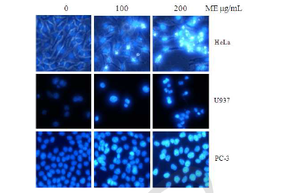 HeLa, U937, PC-3 암세포에서 모자반 추출물의 형태변화에 대한 효과