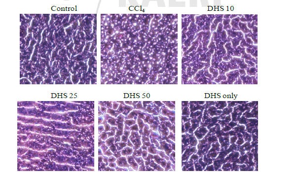 CCl4 투여된 Sprague-Dawley Rat에서 조직학적 변화에 DHS가 미치는 영향