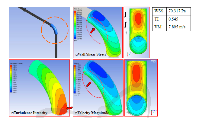 ANSYS FEM analysis for elbow (E02)