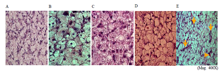 Histological observation of hybrid grouper (RGGG)’s liver tissue in each ammonia. (A) 0 ppm (control), (B) 0.5ppm, (C) 1.0 ppm, (D) 1.5 ppm, (E) 2.0 ppm.