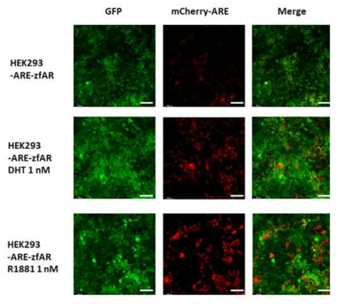 DHT 및 R1881 노출에 따른 HEK293-ARE-zfAR 세포의 ARE promoter 반응 성. (scale bar = 100μm)