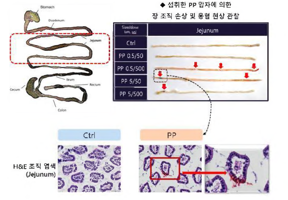 PP 미세플라스틱을 섭취한 생쥐의 장 조직에서 용혈현상 관찰