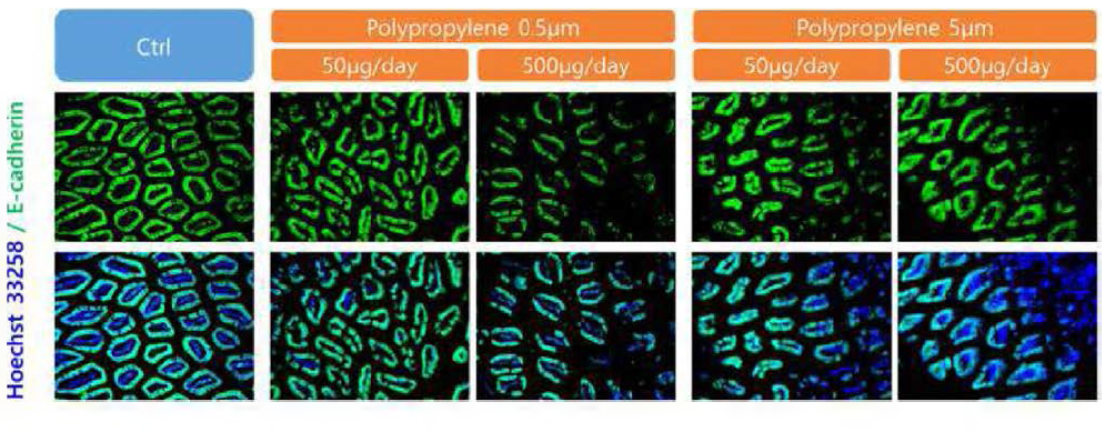 PP 미세플라스틱을 섭취한 생쥐의 장 조직에서 E-cadherin+ 상피세포의 구조적 손상
