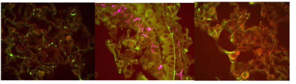 비선형광학이미징으로 관찰된 형광PP가 처리된 생쥐의 폐조직. (좌) control, (중) PP (0.5 µm)처리된 생쥐의 폐, (우) PP (5 µm)처리된 생쥐의 폐