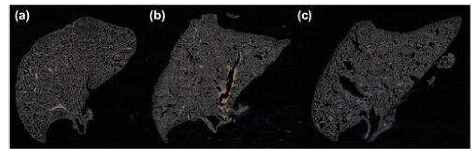 암시야계 현미경으로 이미징한 생쥐의 폐조직 (좌) control, (중) PP (0.5 µm)처리된 생쥐의 폐, (우) PP (5 µm)처리된 생쥐의 폐