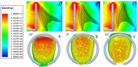 Ansys HFSS 전산모사 소프트웨어를 통해 공진기 코일과 측정 대상 치아를 시뮬레이 션한 결과. 코일과 가까울수록 적용되는 B1 자기장 세기가 강해지는 것을 볼 수 있음.