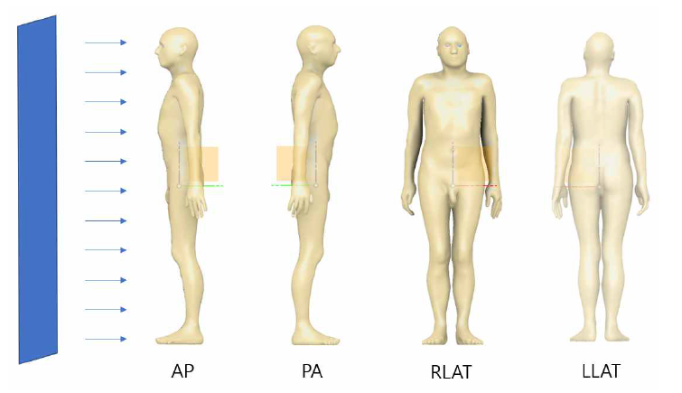 피폭 상황 설정 모습. AP (앞뒤), PA (뒤앞), RLAT (우외), LLAT (좌외) 전신 피폭 상황을 가정하였음