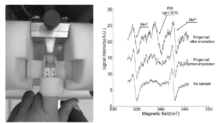 The in vivo EPR spectroscopy of fingernail reference:Junwang Guo et al., The desingn of X-band EPR cavity with narrow detection aperture for in vivo fingernail dosimetry after accidental exposure to ionizing radiation