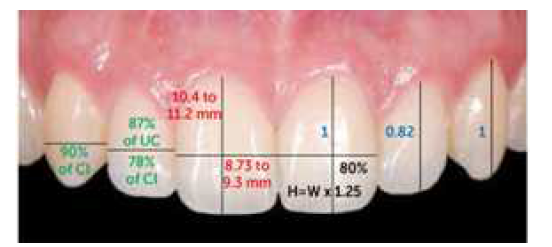 구강 내 치아의 위치 및 크기 (Brandão and Brandão, “Finishing procedures in Orthodontics: dental dimensions and proportions (microesthetics)”, Dental Press J. Orthod. (2013))